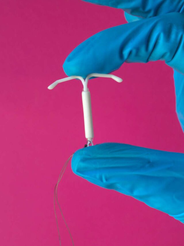 The Surprising Link Between IUDs and Sciatic Nerve Pain