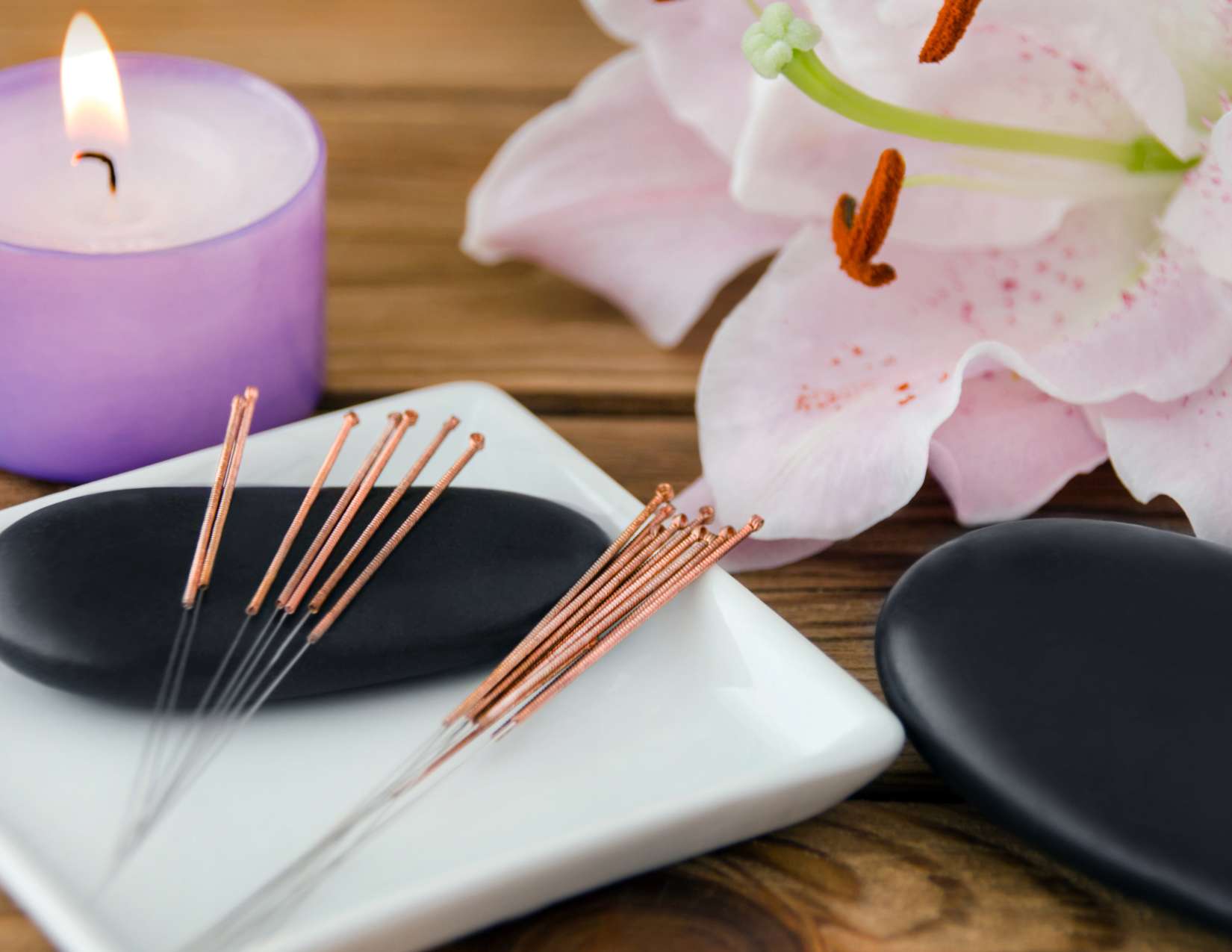 from-prepping-to-relaxing-how-to-prepare-for-acupuncture