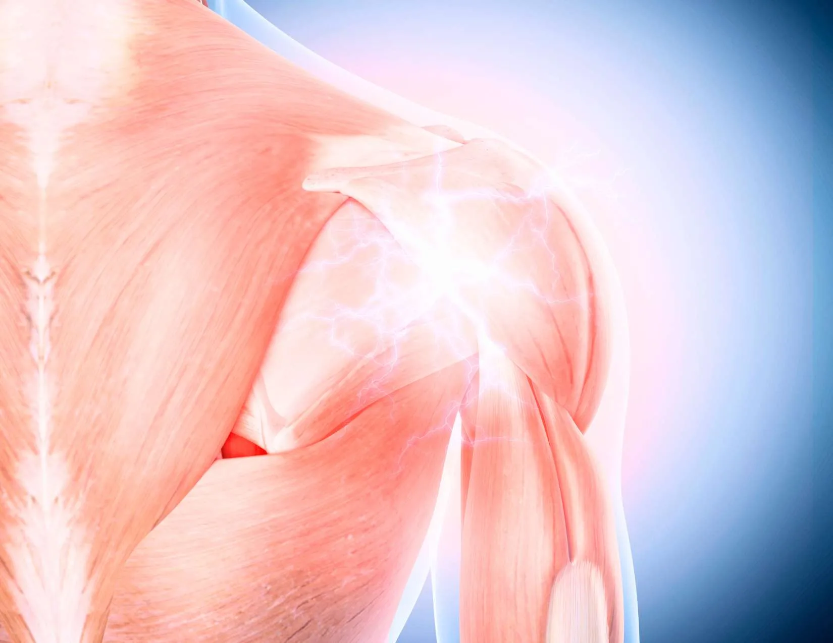 trigger point therapy